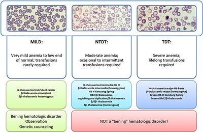 New Insights Into Pathophysiology of β-Thalassemia